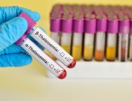 thalassemia N.T