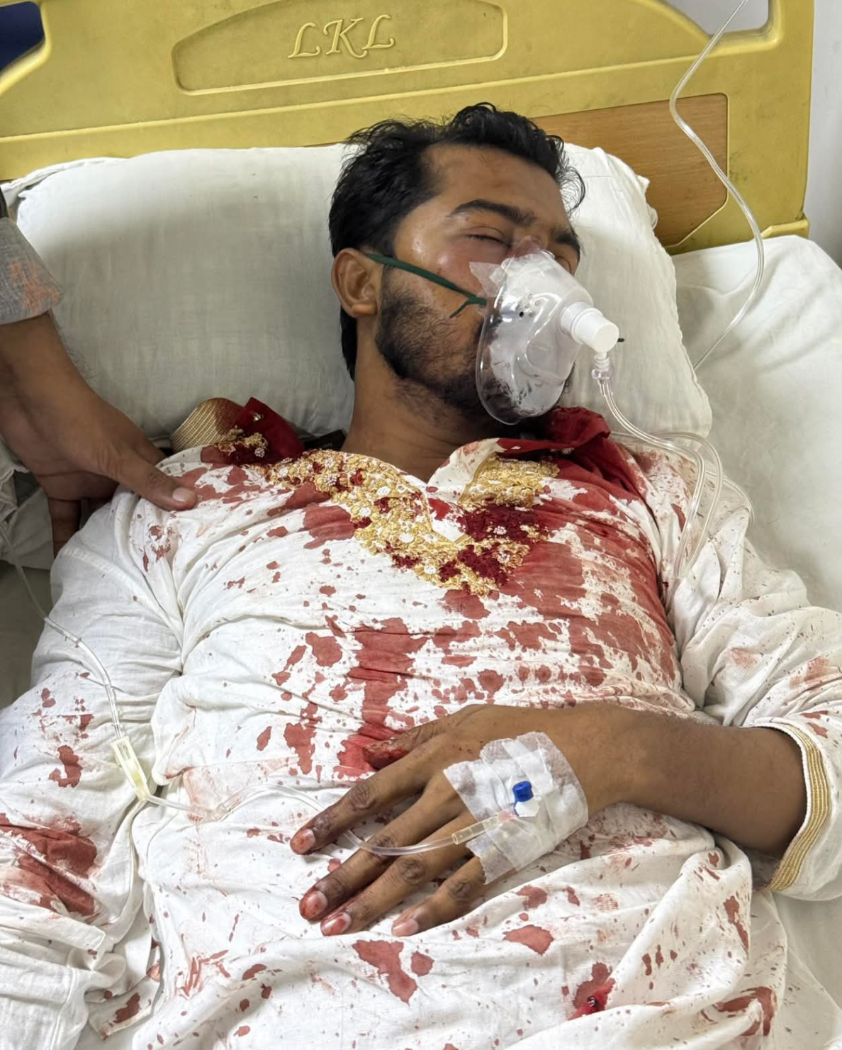 জাপা কার্যালয়ের সামনে ফের সংঘর্ষের ঘটনায় ভিপি নুর মারাত্মক আহত